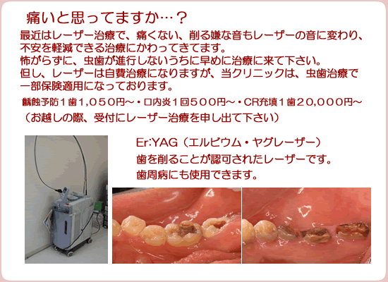 痛いと思ってますか？