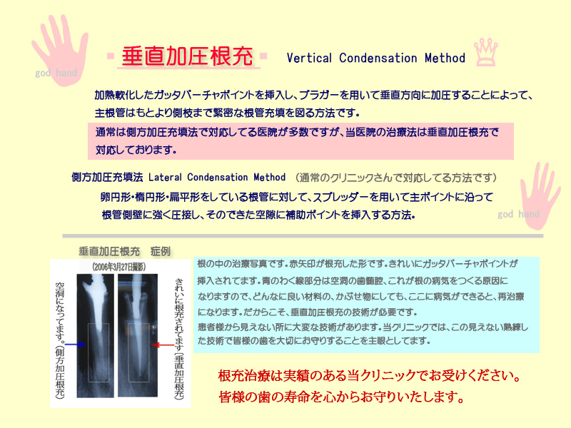 vertical2