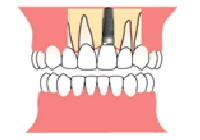 in-1.gif